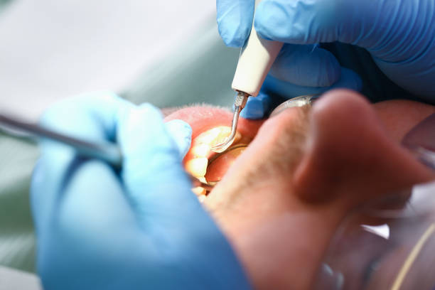 Best Broken or Cracked Tooth Emergency Dentist in Maybrook, NY