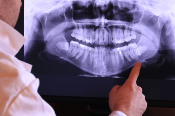 Best Emergency Dental Services for Seniors in Maybrook, NY